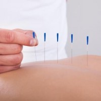 Hikke kan kureres med akupunktur